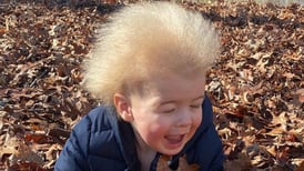 El curioso caso de Lockan, el niño que sufre el “Síndrome del pelo impeinable”