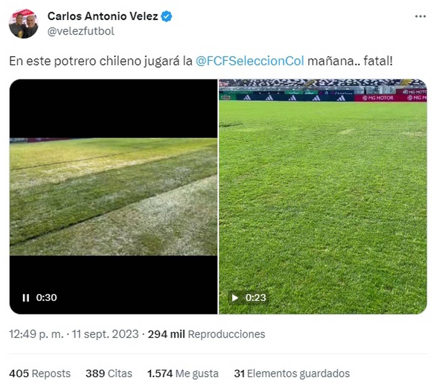 El comunicador cafetero calificó de "potrero" a la cancha del estadio Monumental a un día de disputarse ahí el encuentro entre Chile y Colombia.