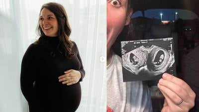 Increíble: Una mujer con 2 úteros está embarazada en ambos
