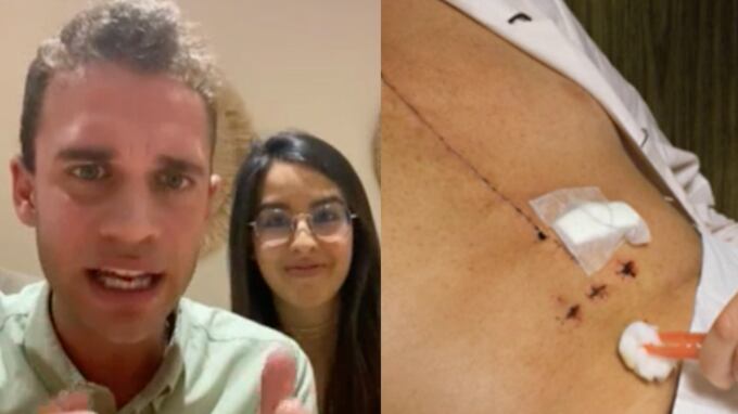 Lo operaron del corazón por comerse las uñas