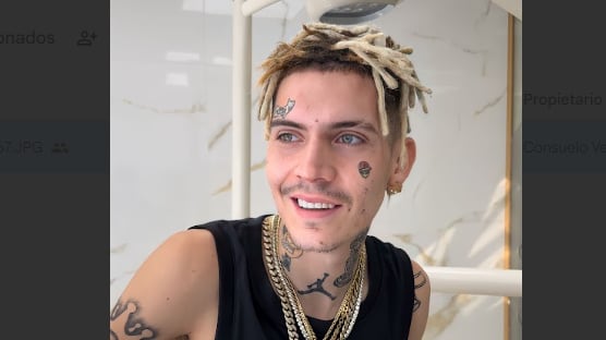 "Hoy vino a vernos @marcianeke para su armonización facial masculina!", escribió la doctora Vivianne Echagüe, la misma a cargo de embellecer a distintos famosos Ignacia Michelson, Julio César Rodríguez, Wilma Gonzalez , Dj Lizz , Valentina Dávila, Cote lopez , la Sazon, Gissella gallardo y Claudio Palma, entre muchos otros.
En un video compartido en la red social, con la canción Mini Mini de fondo, el cantante urbano recibe distintos pinchazos en el rostro, el cual tenía anestesiado para no sentir dolor.
Según detallaron desde el centro, le realizaron "borde mandibular, rinomodelación y relleno de surco nasogeniano".