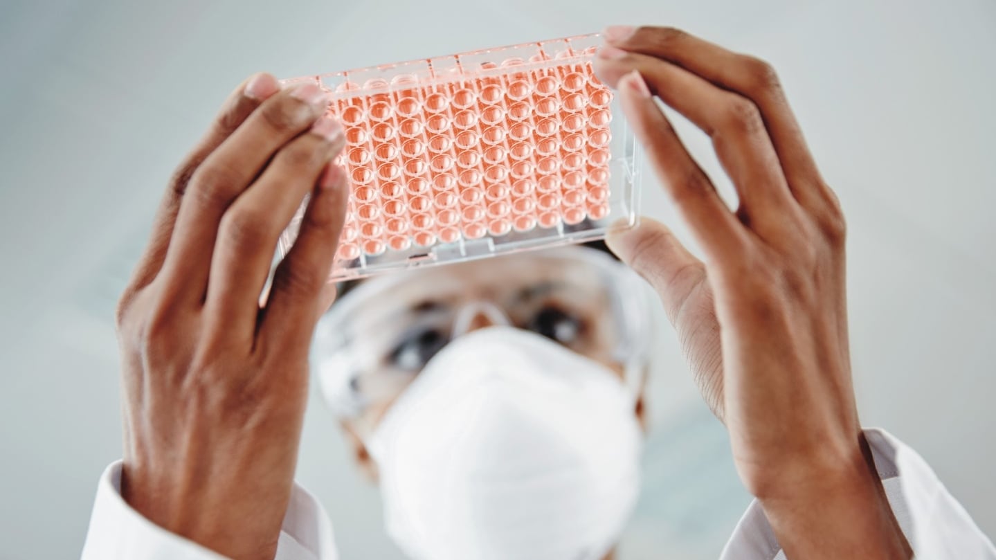 Imagen de referencia de ensayo en un laboratorio clínico.