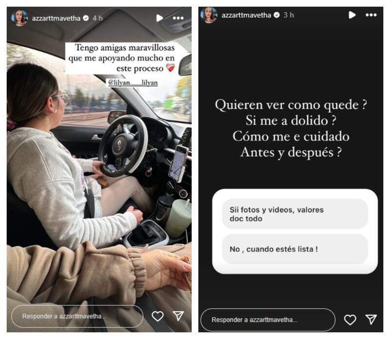 La joven de 29 años, exparticipante del reality "Tierra Brava", se sometió a una cirugía de lipoescultura.