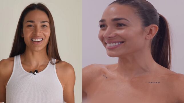 La modelo cubana Lisandra Silva compartió con sus seguidoras la operación que se realizó para quitarse los implantes mamarios, puesto que sufrieron una abrupta caída tras sus dos embarazos de sus pequeños Noah y Leiah.
“Es algo que he estado deseando por mucho tiempo. Luego de mis dos embarazos mis senos cambiaron considerablemente. Sentí que ya no armonizaban mi cuerpo como antes”, comentó en la red social, junto a un video mostrando todo el proceso médico.
Además, la exparticipante de “Aquí se baila”, pareja de Raúl Peralta, mostró cómo estaban sus senos antes de la operación, dando cuenta que la prótesis había cambiado de lugar.
“Si se fijan, yo hago un poco de fuerza y la prótesis está acá arriba, y el pezón está abajo. Lo queremos acá arriba, entonces vamos a hacer un trabajo espectacular, para que queden como tienen que estar”, expresó.