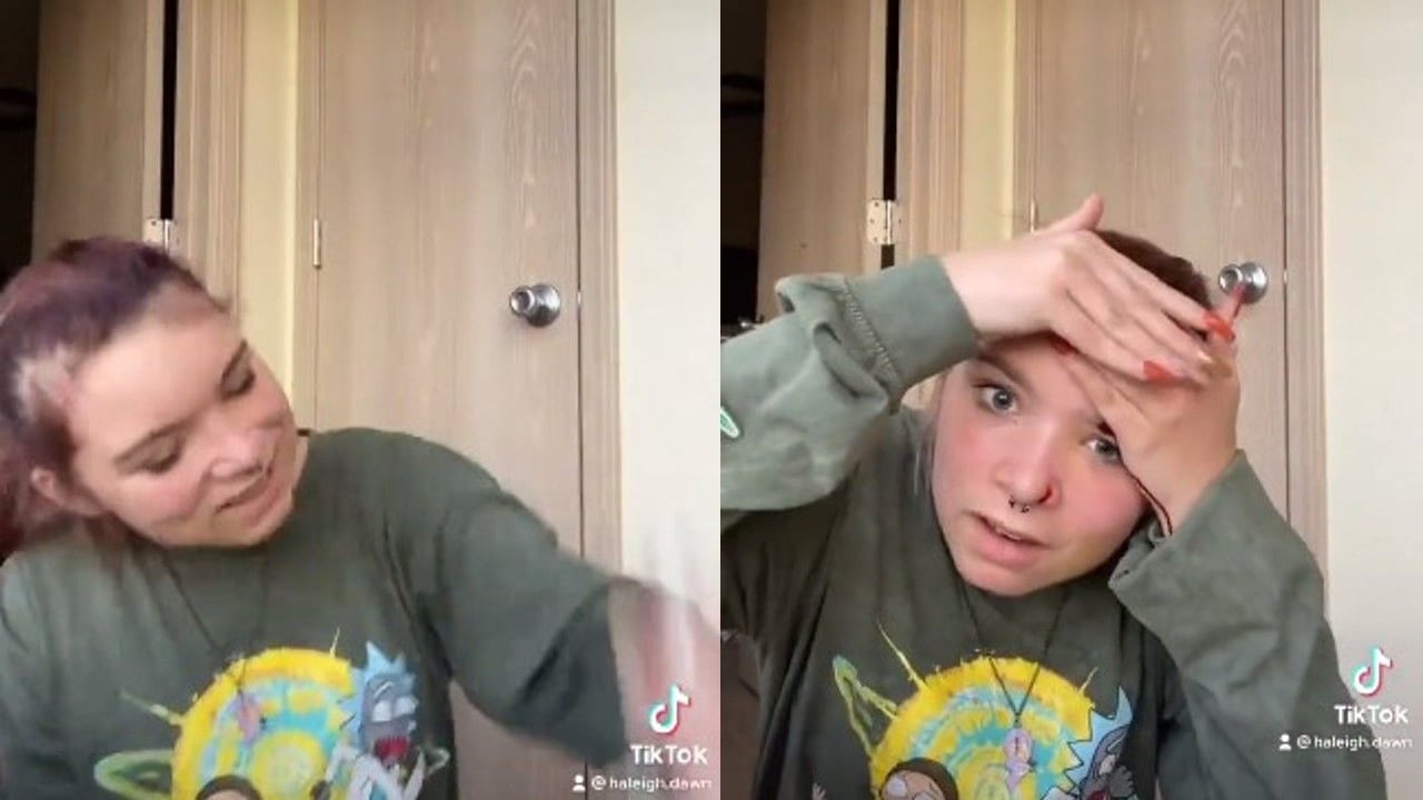 Joven se corta la cara al intentar hacer un video viral en TikTok