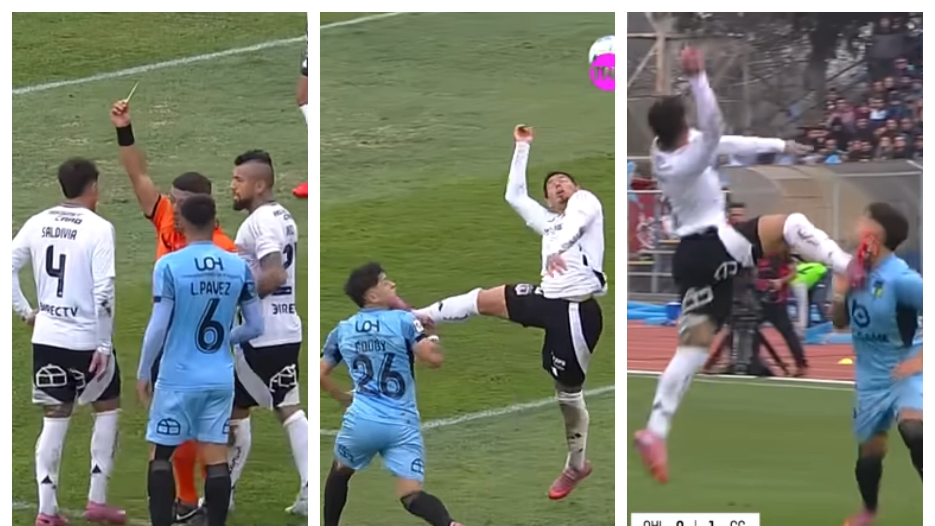 La Comisión de Árbitros de la ANFP reconoció que el defensor de Colo Colo debió haber sido sancionado con una tarjeta roja por su violento golpe al futbolista rancagüino.