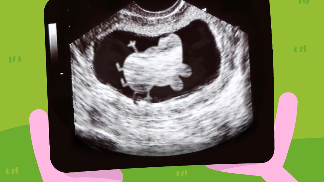 Peppa Pig