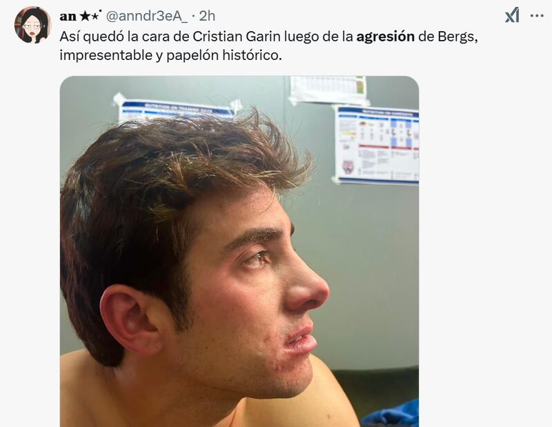 Comentarios sobre Cristian Garin | Captura: X