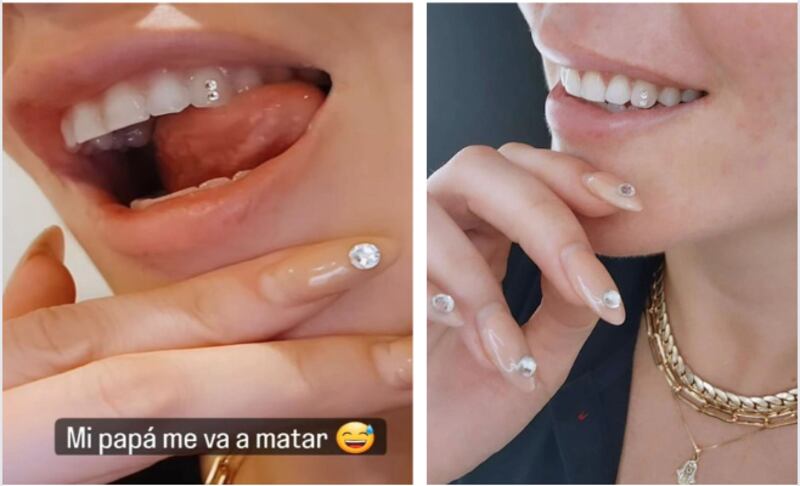 Durante la jornada de este lunes, Kel Calderón compartió un par de publicaciones que estuvieron lejos de pasar desapercibidas entre sus seguidores y seguidoras en las redes sociales.
A través de sus historias de Instagram, reveló que tomó la decisión de colocarse una joya en sus dientes. Esto, junto a una foto donde confirmaba el hecho.
“Hace tanto tiempo que quería hacer esto y mi dentista me terminó de convencer. Lista para Singapur bebés”, escribió la egresada de derecho junto al registro.