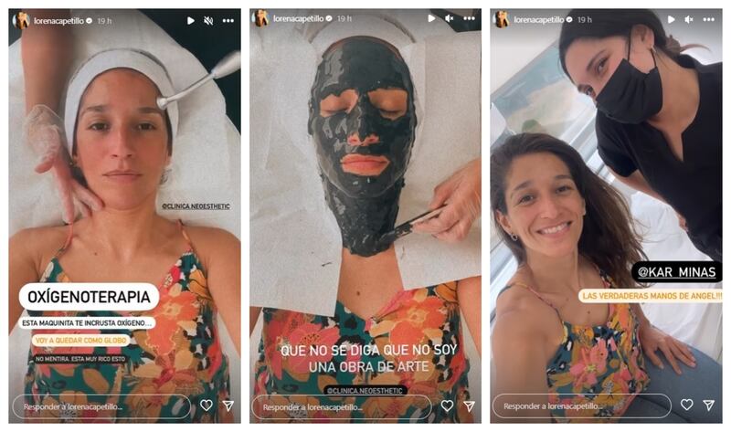 La secuencia de imágenes del tratamiento facial que se realizó la actriz de "Hasta encontrarte".