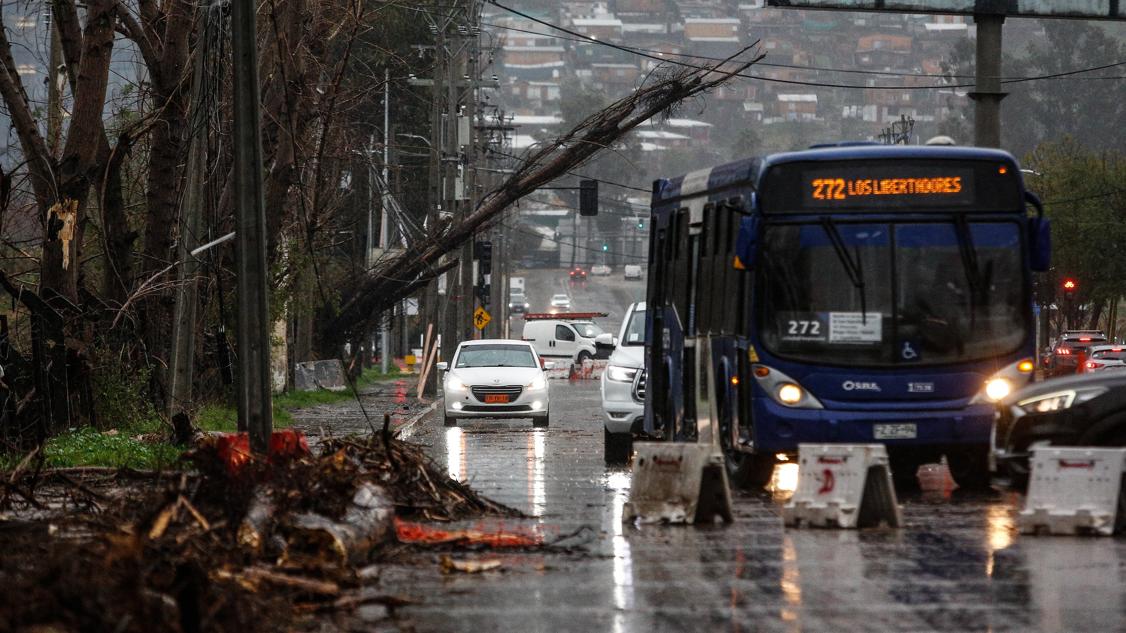 Sistema frontal en la RM