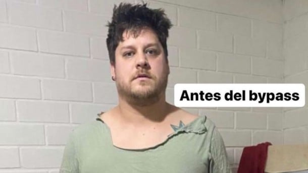 El exchico "Yingo", Ariel Osses, mejor conocido como "Elfi", compartió imágenes del antes y después de su reciente cirugía bariátrica, dejando ver un drástico cambio en su aspecto físico.
Recordemos que, a mediados del 2022, el creador de contenido sorprendió a sus seguidores al revelar que viajó hasta Colombia para someterse a una liposucción con abdominoplastia, con el fin de bajar de peso.