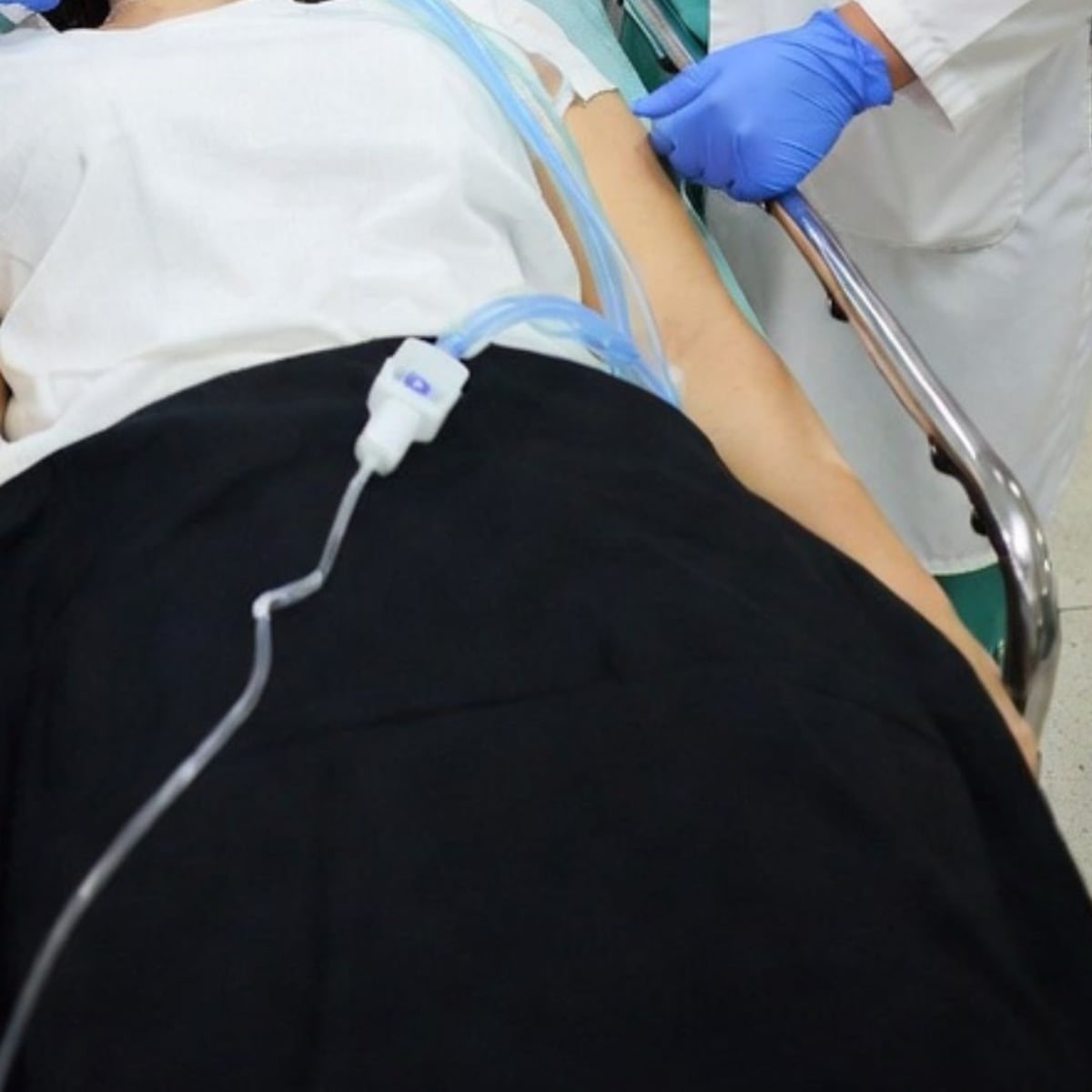 Mujer en estado crítico tras paro cardiorrespiratorio en cirugía estética Mujer en estado crítico tras paro cardiorrespiratorio en cirugía estética