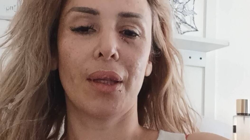 Debido a complicaciones con los medicamentos, la figura televisiva debió ser internada nuevamente en el Hospital del Salvador.