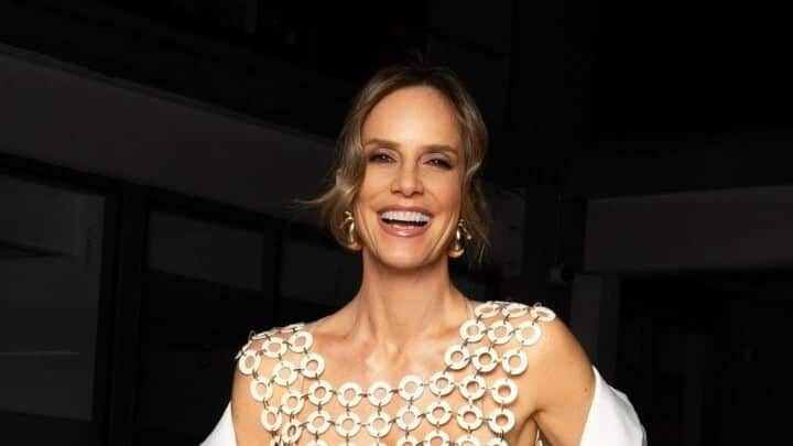 Diana Bolocco cuenta cuál fue su única cirugía estética que transformó su vida