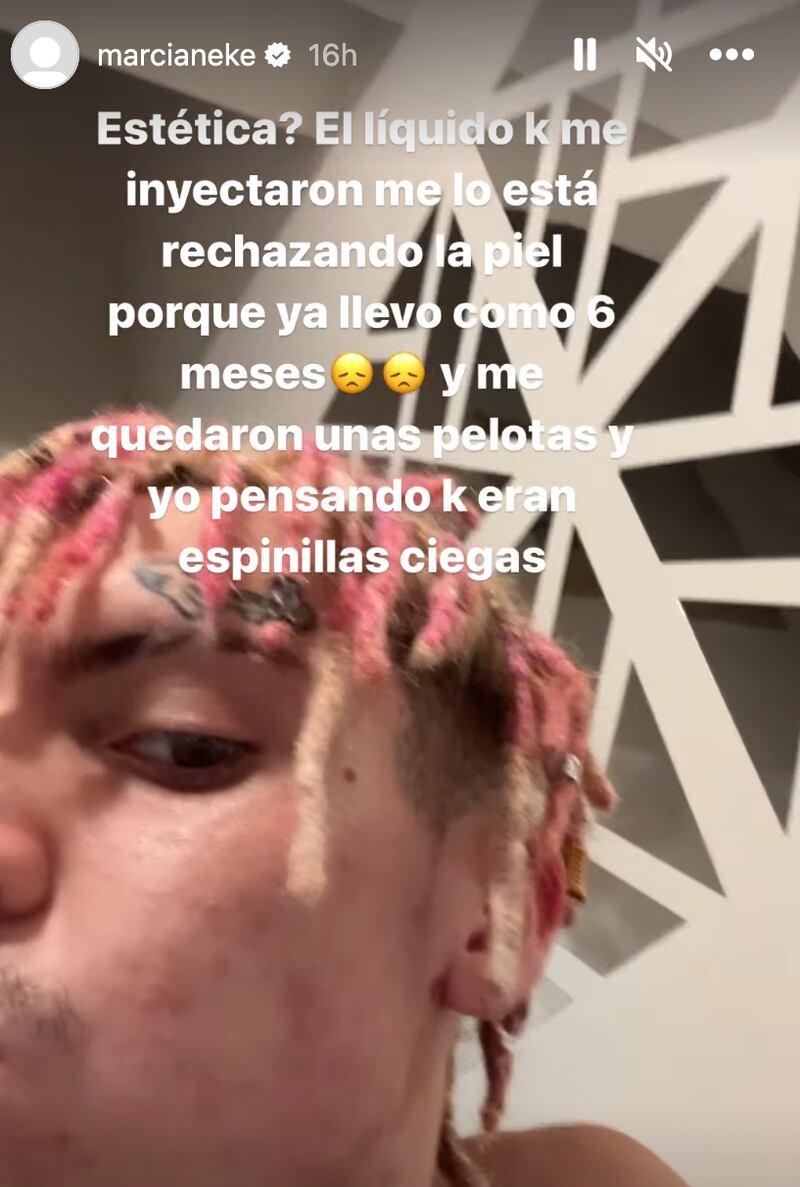 Storie Marcianeke