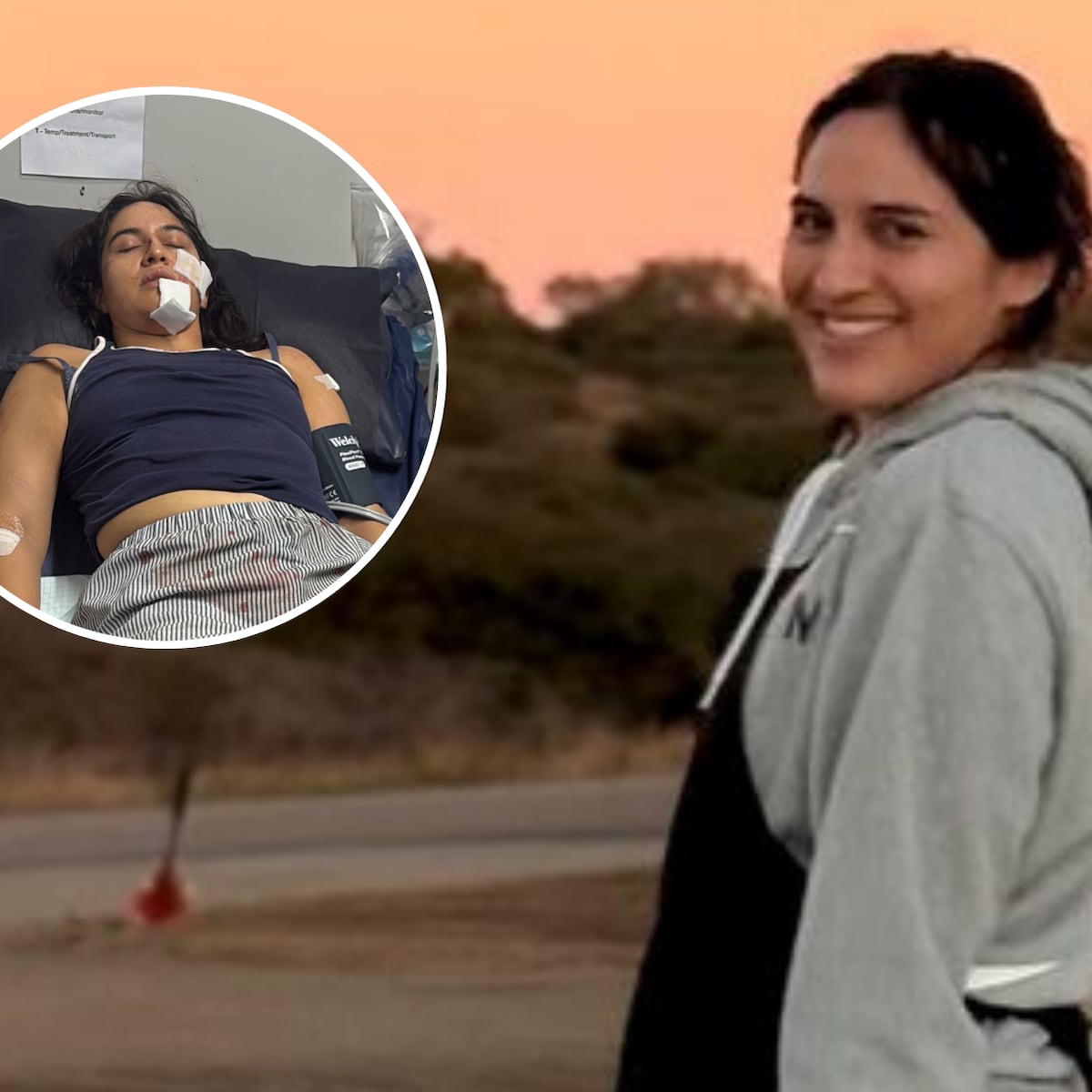 Chilena sobrevive a ataque de urraca en Australia Chilena sobrevive a ataque de urraca en Australia