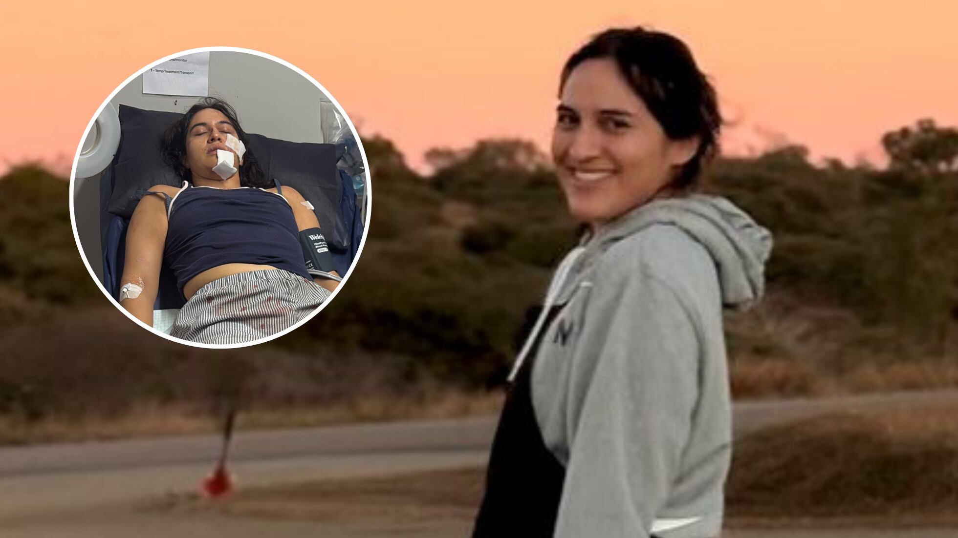 “Tengo suerte de estar viva”: Chilena sufrió grave accidente tras ataque de urraca en Australia y necesita cirugía reconstructiva