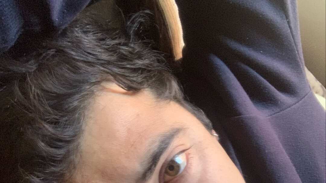 El hombre herido es Roderick Castro.