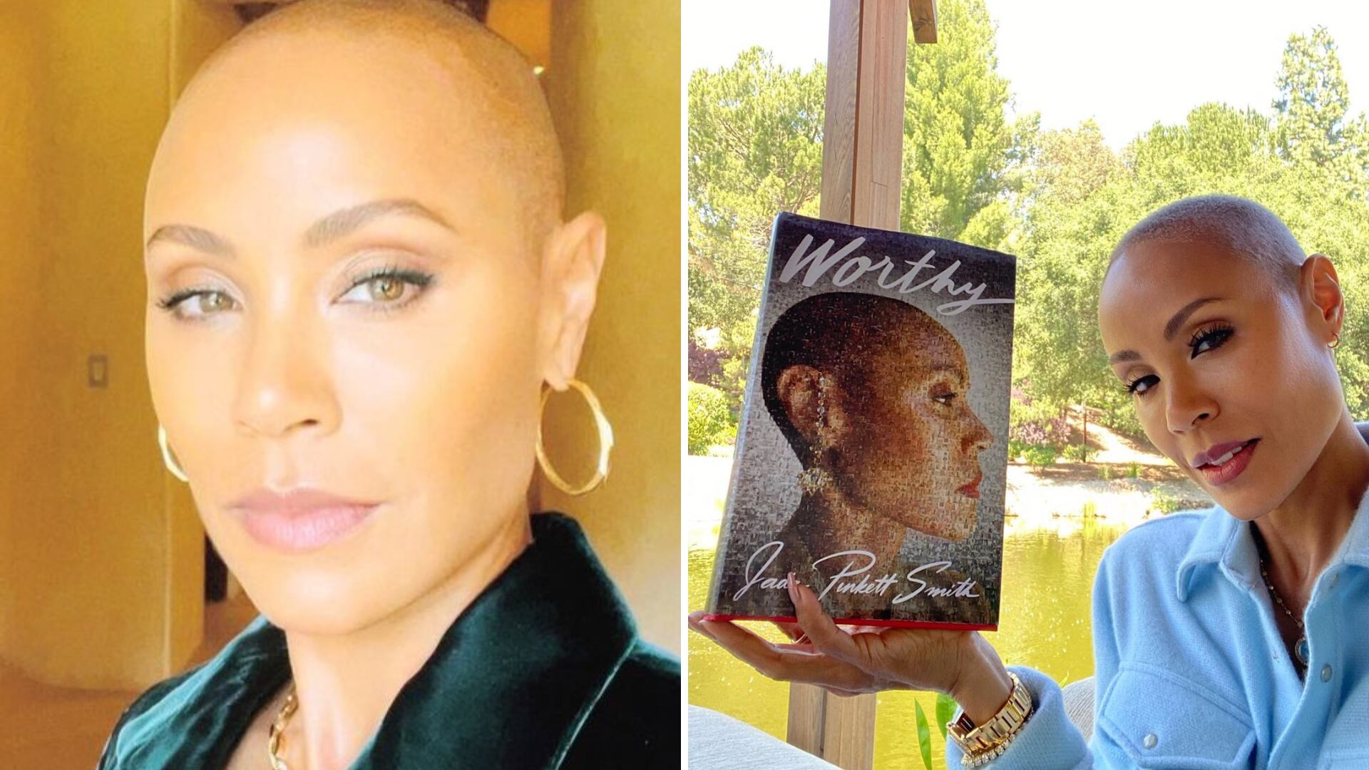 La actriz anunció en el 2018 que padecía de alopecia. El comediante Chris Brown se burló de su condición en los Oscar y Will Smith lo abofeteó.