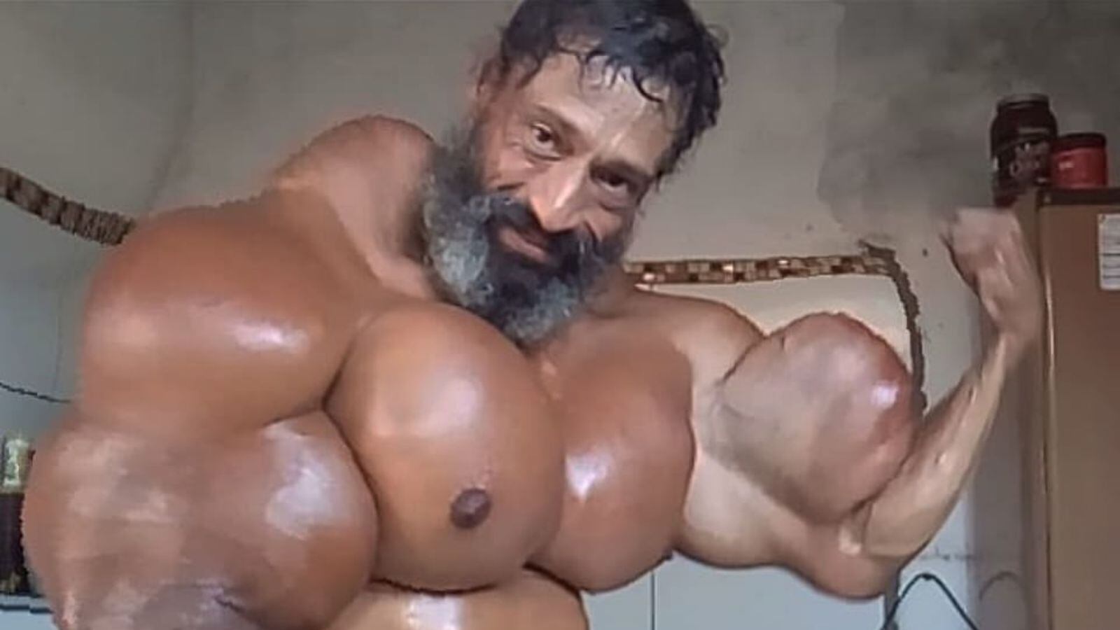 Murió Valdir Segato, el “Hulk brasileño” que se inyectaba peligrosa sustancia para hacer crecer sus músculos