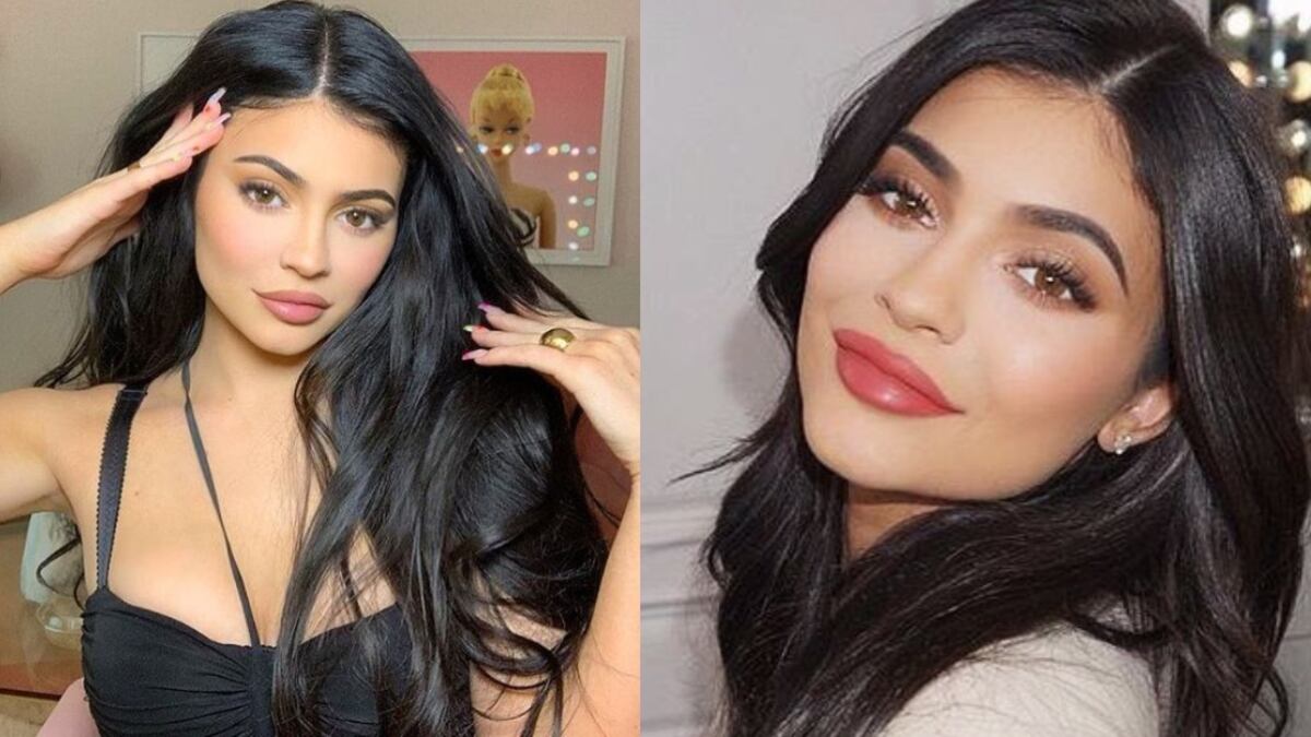 Los labios de Kylie Jenner