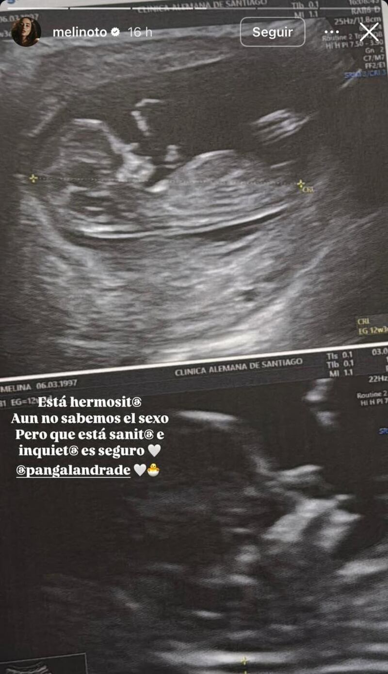 Melina Noto muestra la primera ecografía de su bebé junto a Pangal Andrade: “Está sanit@ e inquiet@”