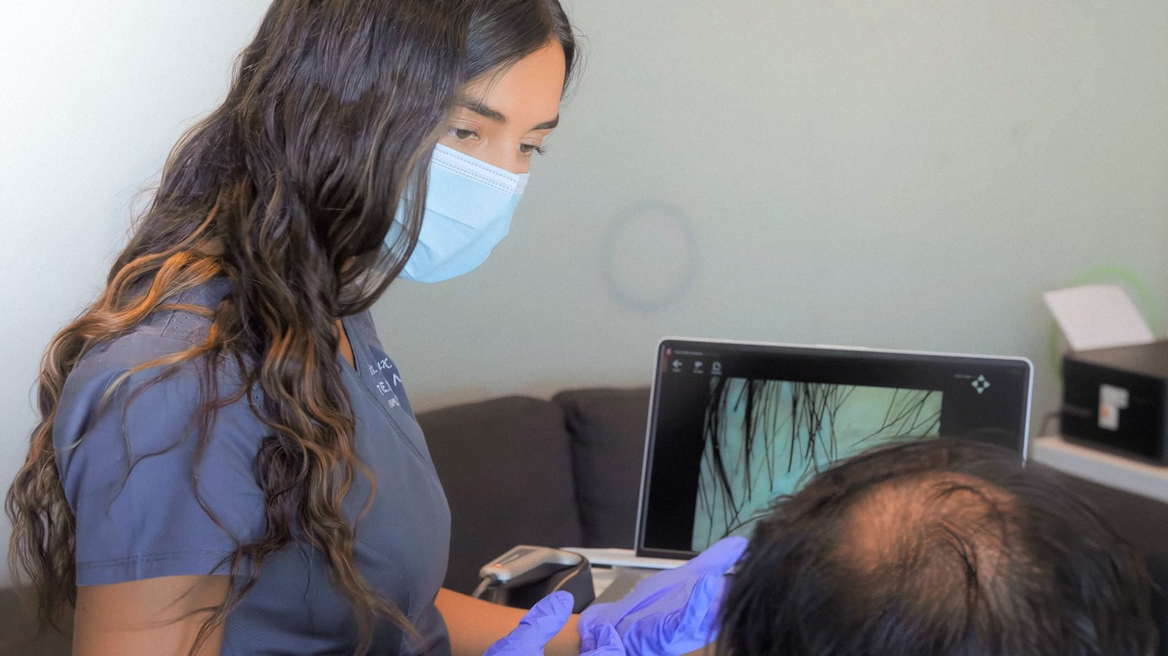 Alopecia en hombres: implante capilar se rejuvenece en Chile