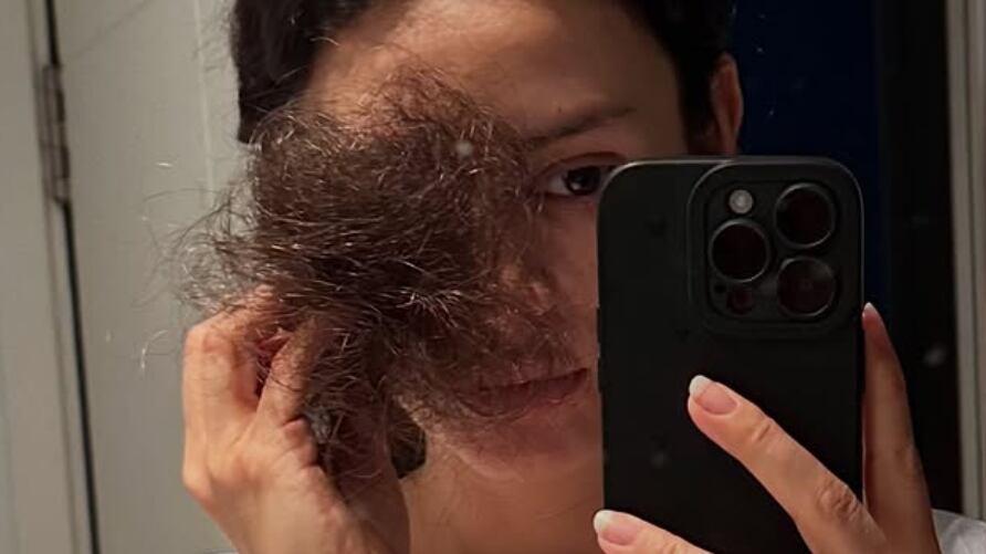 La fuerte reflexión de Karla Melo en pleno tratamiento contra el cáncer: “Que se nos caiga el pelo es una de las cosas más fuertes”.