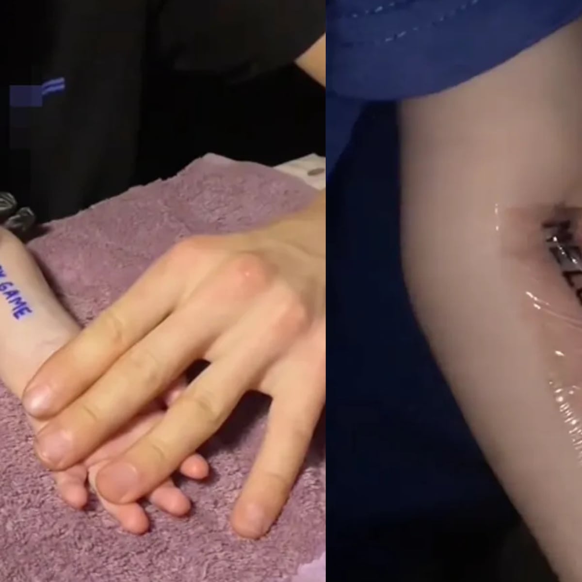 Bielorrusia: bebé tatuado por sorteo de streamer Bielorrusia: bebé tatuado por sorteo de streamer