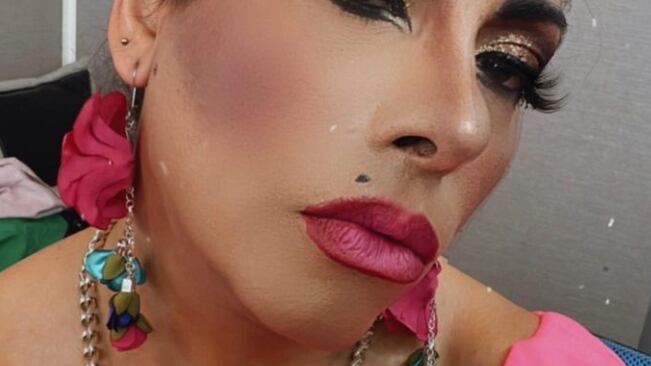 Botota Fox es una de las transformistas más queridas de Chile, con una trayectoria en televisión y en Internet, ha logrado un lugar en el espectáculo nacional.
Y el cariño de la gente es innegable, por eso cuando ocurren actos de violencia como el que denunció en la madrugada del 31 de enero, se encienden las alarmas en redes.
“Se que no quería escribir esto ,pero me siento tan devastando, con mucha pena, porque no merezco que me peguen”, comenzó escribiendo en un post en Instagram.
“Me defiendo de no ir más al circo #labotaysusamigas en el Marga Marga, creo que nadie se merece que te violenten, menos basuras”, afirmó sin dar mayores detalles de lo ocurrido.