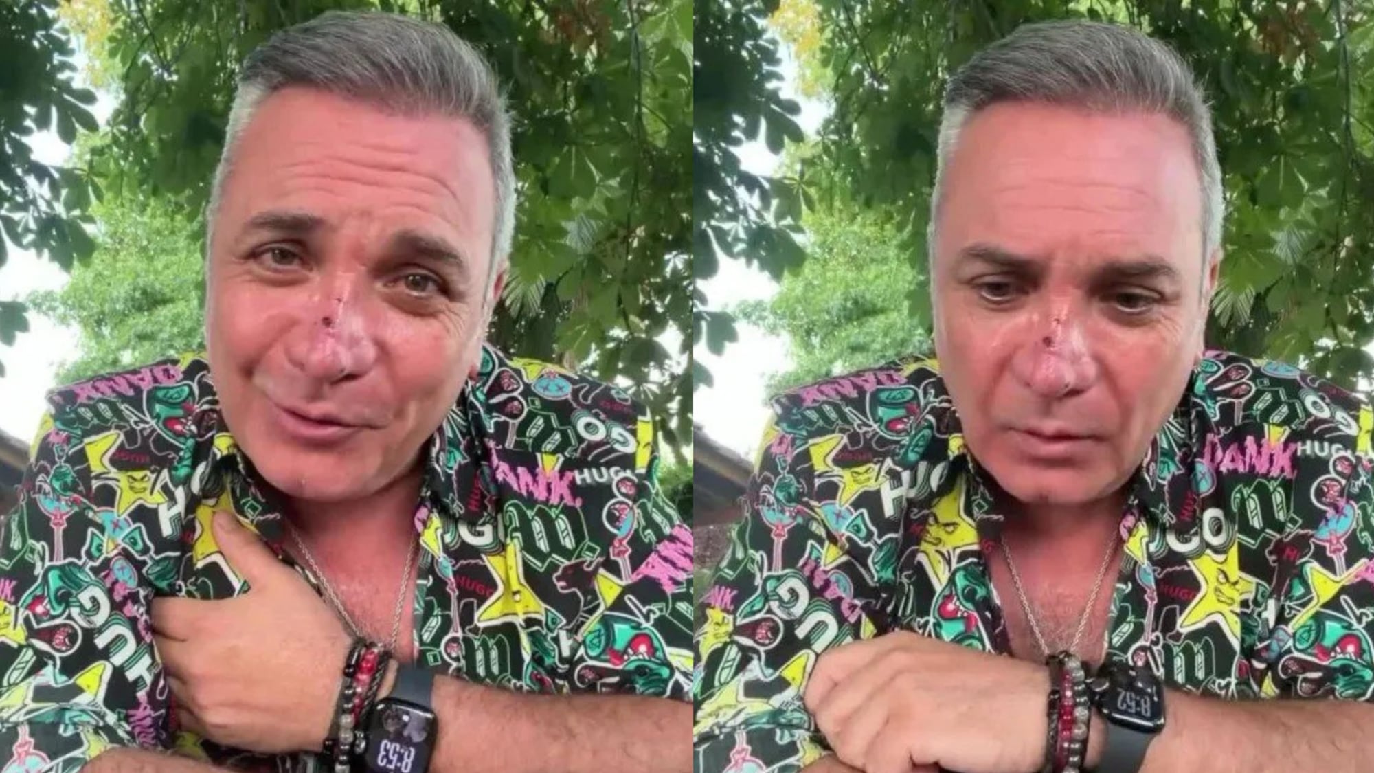 “Son cicatrices visibles”: Luis Jara revela que fue mordido por un perro en el rostro y entrega potente mensaje de cierre de año