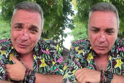 “Son cicatrices visibles”: Luis Jara revela que fue mordido por un perro en el rostro y entrega potente mensaje de cierre de año