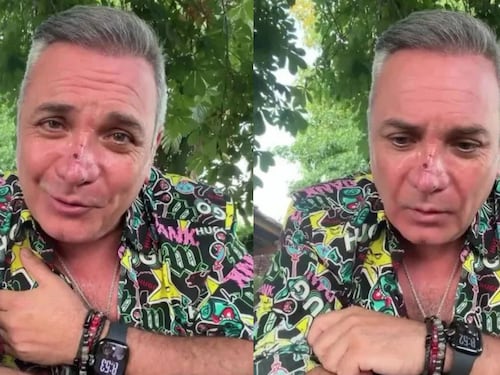 “Son cicatrices visibles”: Luis Jara revela que fue mordido por un perro en el rostro y entrega potente mensaje de cierre de año