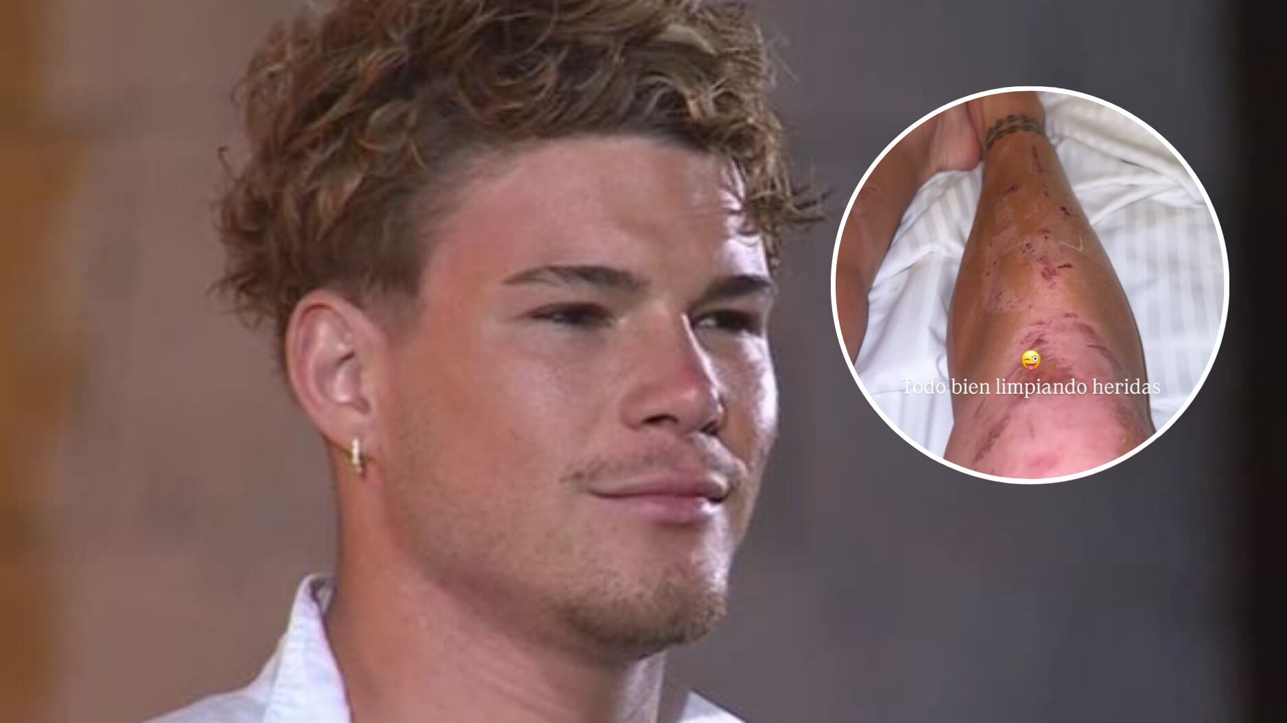 Raimundo Cerda reaparece tras ser hospitalizado y entrega mensaje desde la clínica: “Limpiando Heridas”