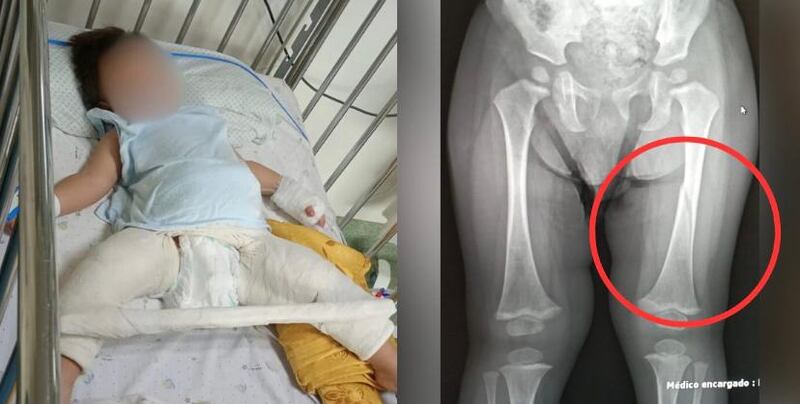 Fotografía por biobiochile.cl