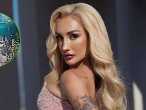 “Caí en un hoyo”: El crudo relato de Fran Maira tras grave accidente de tránsito