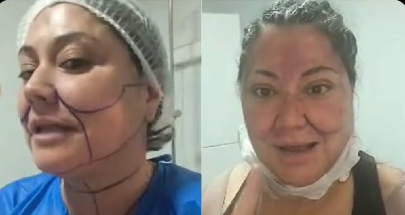 Postoperatorio al que se sometió Denisse Campos (Captura de Pantalla)