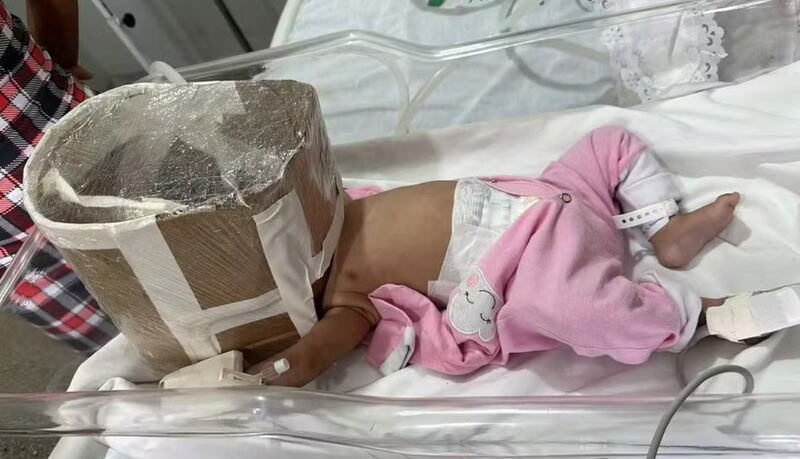 Embalaje torta en hospital de Brasil | Fuente: G1
