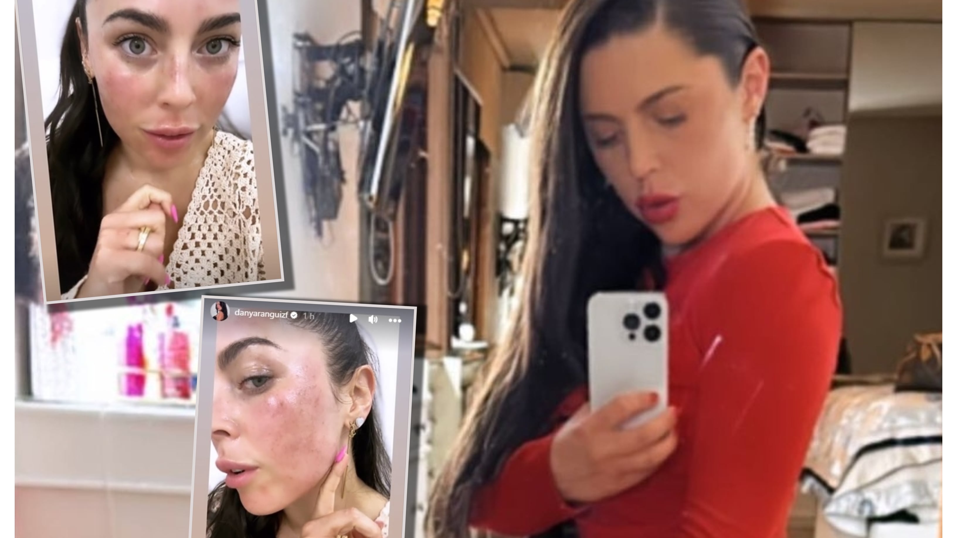 La figura de Zona Latina se realizó un nuevo tratamiento estético para reducir el volumen de sus pómulos.