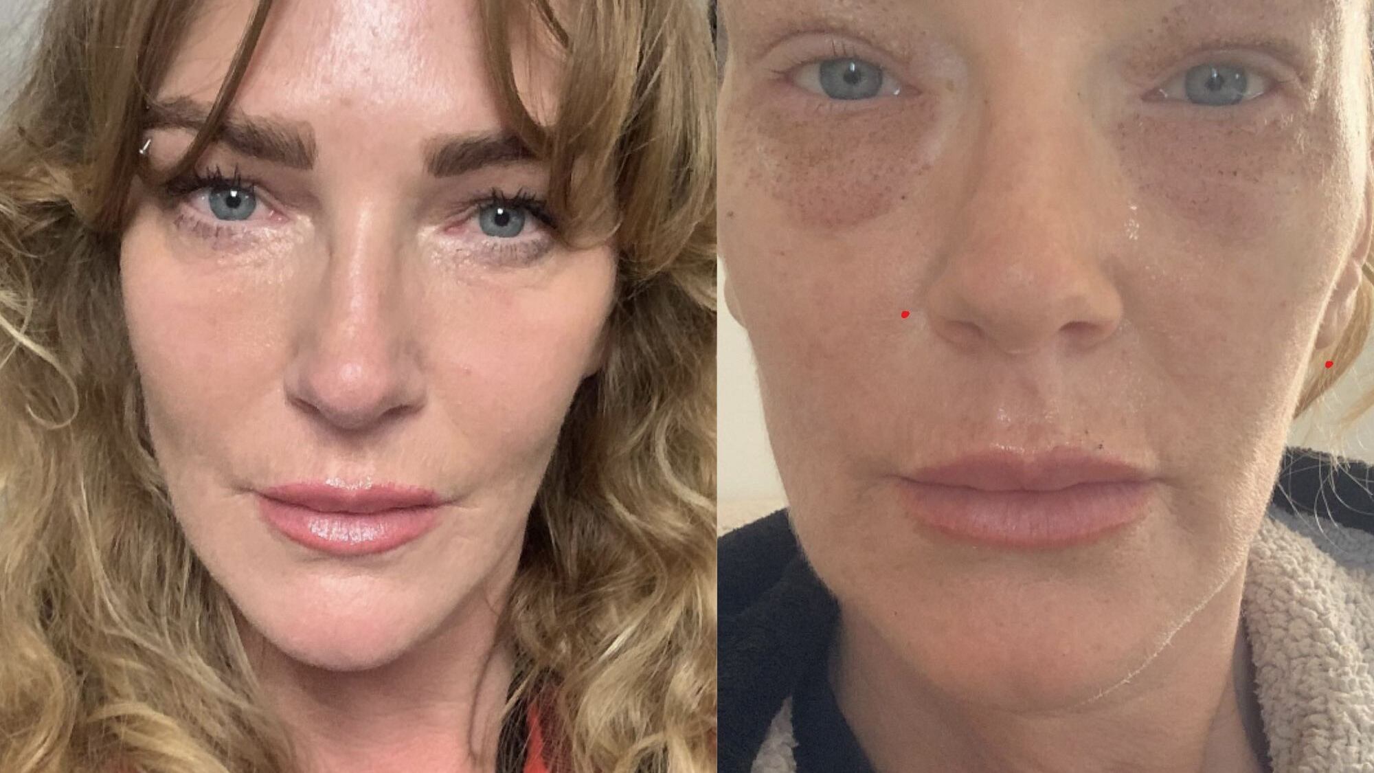 “Por razones médicas”: Cata Pulido mostró imágenes de su nuevo “Por razones médicas”: Cata Pulido mostró imágenes de su nuevo