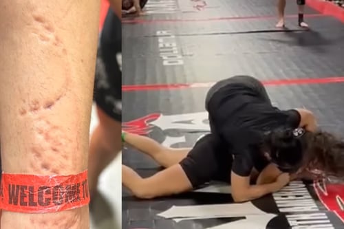 Video: Luchadora muestra cómo su rival la mordió repetidamente en lugar de pelear