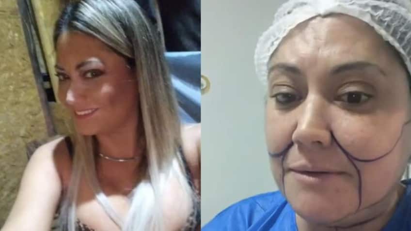 Denisse Campos se somete a varias cirugías