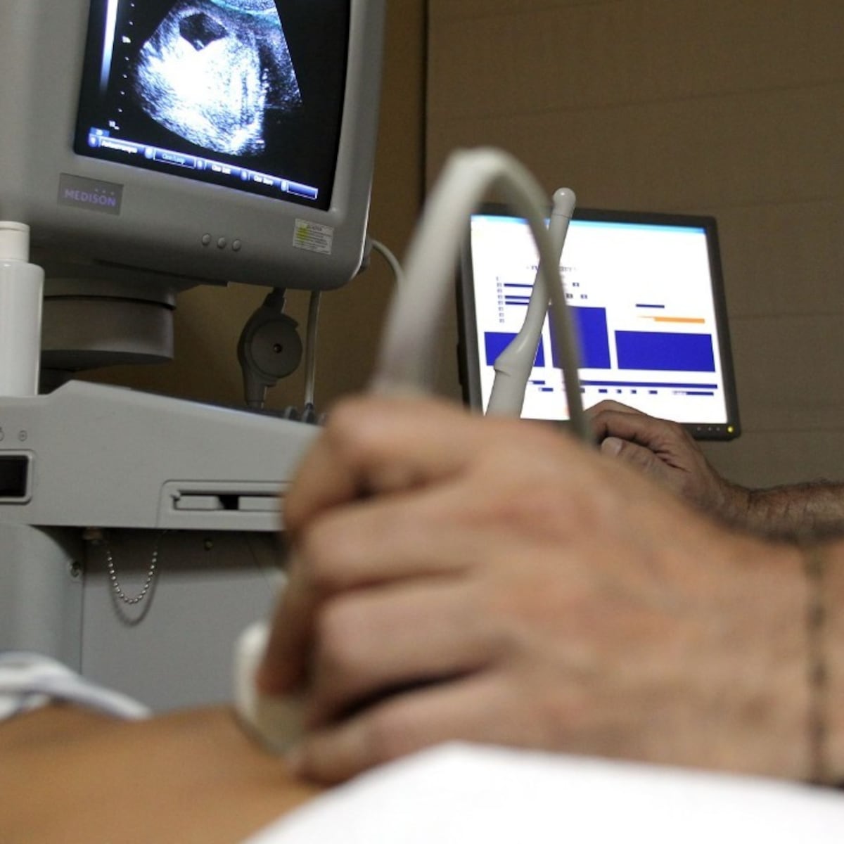 Madre formalizada por aborto a hija de 16 años en Coyhaique Madre formalizada por aborto a hija de 16 años en Coyhaique