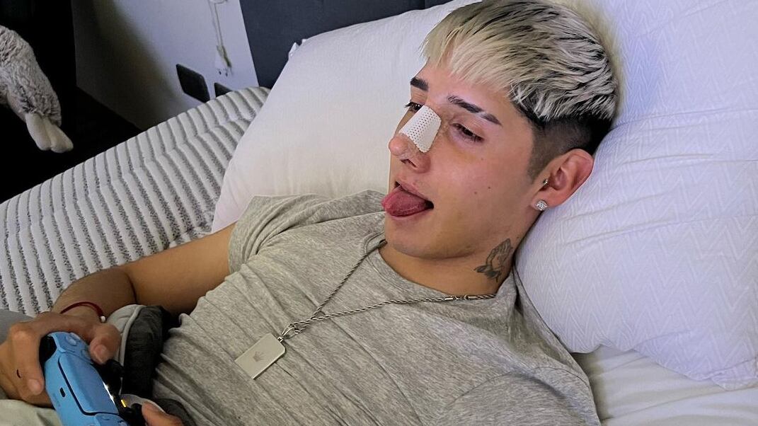 El cantante nacional sigue realizando su postoperatorio tras la cirugía nasal que se realizó a mediados de agosto.