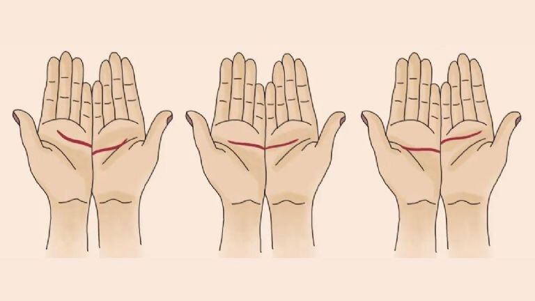 Elige una de las opciones.