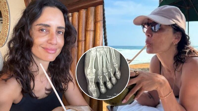 Leonor Varela sufrió grave accidente durante sus vacaciones en México: “Triple fractura de un hueso”