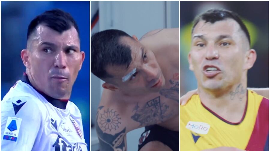 Gary Medel