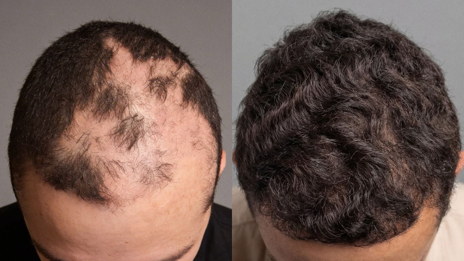 La cirugía es una apuesta clínica y emocional