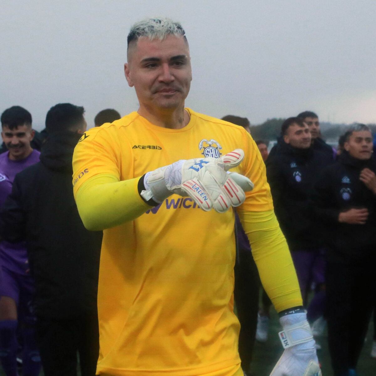 Especialista explica la amputación traumática de Cristóbal Campos Especialista explica la amputación traumática de Cristóbal Campos